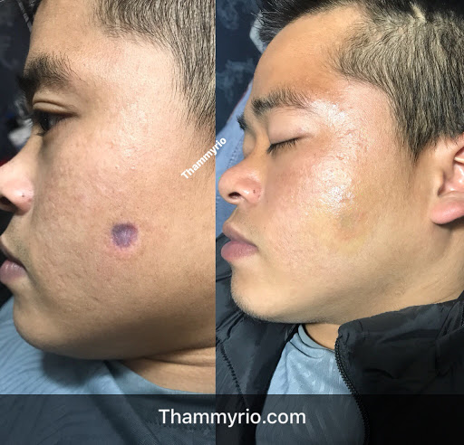 Thẩm