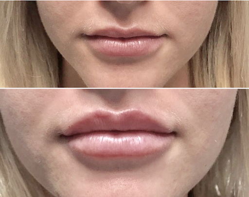 Prime MD Aesthetics + Wellness