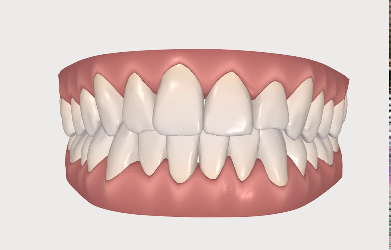 SpeedSmile Dr. Stephania Mohrbutter