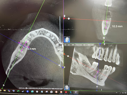 Dentiste Dr Nathan ABBOU