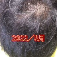 RECOLTE Koike 美容室＆増毛エクステ