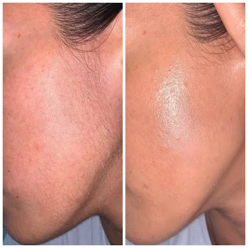 Lanasuperfine Beauty - Thumbnail
