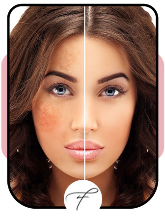 Flawless Medspa Las Vegas