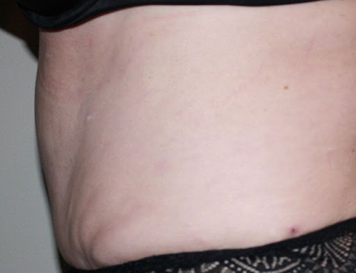 Zieg Plastic Surgery Center