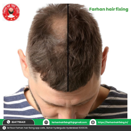🌟 Farhan Hair Fixing 🌟
