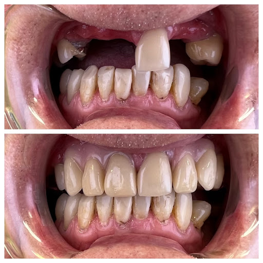 All Smiles Denture Clinic