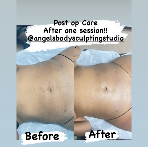 Angel's body sculpting studio Gallery - United States