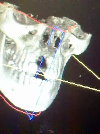 Whittaker Dental - Thumbnail