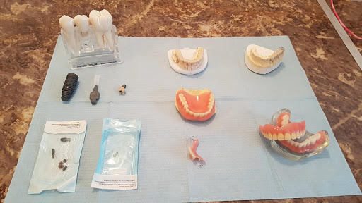 Dental Implants Ireland - Thumbnail