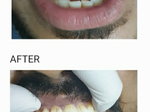 Smile designing post image