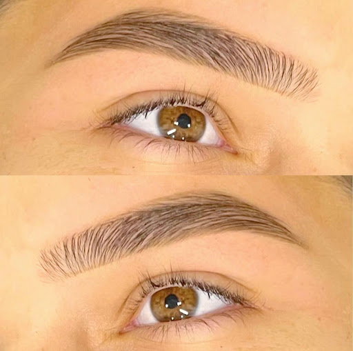 Brow FIX Gallery - Australia