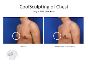 Photo n°18 de Epilation Laser | Centre de Chirurgie Esthétique Cannes à Cannes (Clinique de chirurgie plastique)