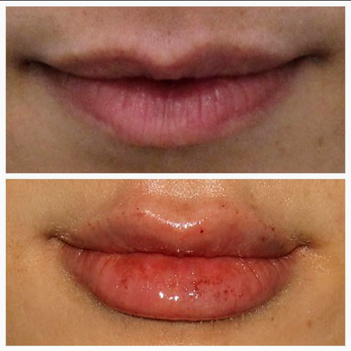 YouthFill MD Med Spa - Beverly Hills