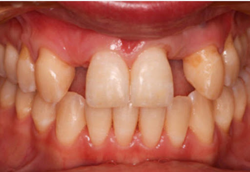 ProSmiles Dentist Collingwood - Thumbnail