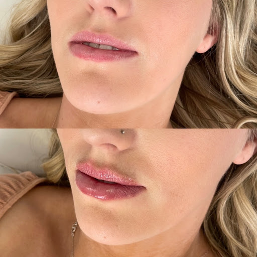 Injected by Bri - Thumbnail