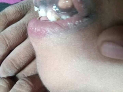 Cured within 2 weeks (Dr Soumya Dey's Clinic desk)  post image
