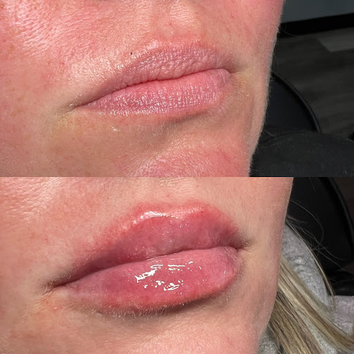 CALI MedSpa