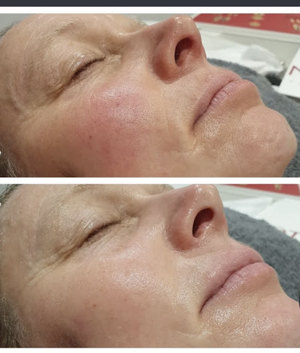 The Still Rooms Beauty Clinic