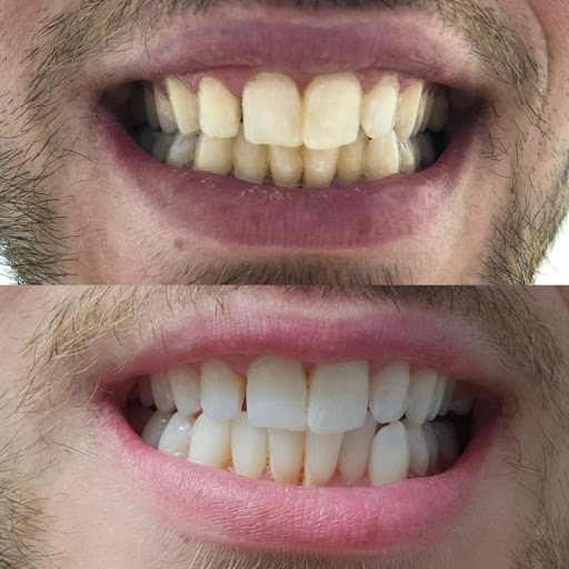 DentaNova - Visual