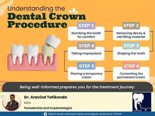 During a dental crown procedure, the damaged tooth is prepared by removing decay shaping the toot… post image