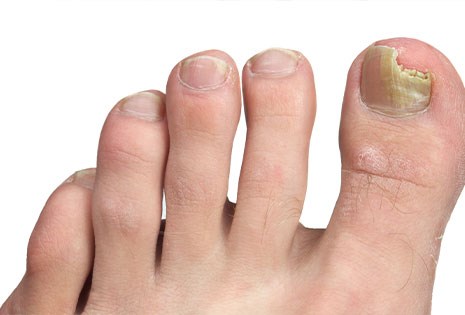 Step Ahead Podiatry Clinic Gallery - Canada
