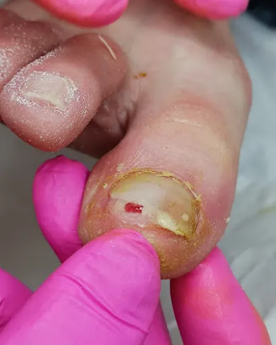 ΠΟΔΟΛΟΓΙΚΟ ΚΕΝΤΡΟ ΠΕΝΥ ΚΑΜΑΡΙΝΟΥ (Επιμελήτρια - Καθηγ. Ποδολογίας) Ποδολόγος Ποδίατρος - Γιατρός