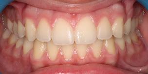 Photo n°2 de DR GUILLERMIN Anthony Louis - Orthodontie - Pratique réservée à l'orthodontie à Mantes-la-Jolie (Dentiste)