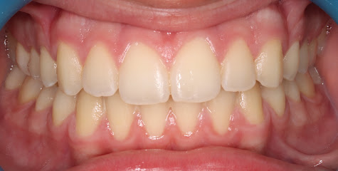 DR GUILLERMIN Anthony Louis - Orthodontie - Pratique réservée à l'orthodontie