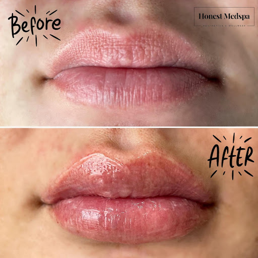 Honest MedSpa - Thumbnail