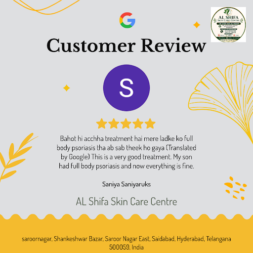 Saniya Saniyaruks raves about her exceptional experience at AL Shifa Skin Care Centre in Hyderaba… post image