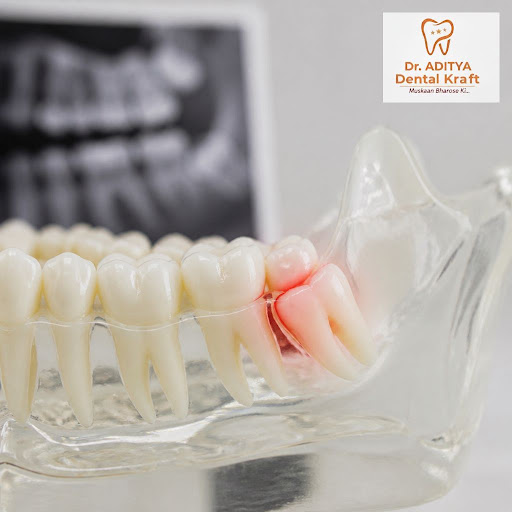 Painful or swollen wisdom teeth can affect your daily life, sleep, and even your smile. At Dr. Ad… post image