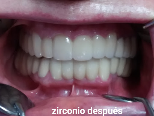 Clínica dental Santa Apolonia - Thumbnail