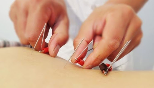 Dott.ssa Nadia Giavelli Agopuntore - Thumbnail