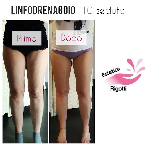 Centro Estetico Rigotti - Thumbnail