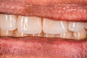 Photo n°4 de Dr Edouard Hampartzoumian à Toulon (Dentiste)