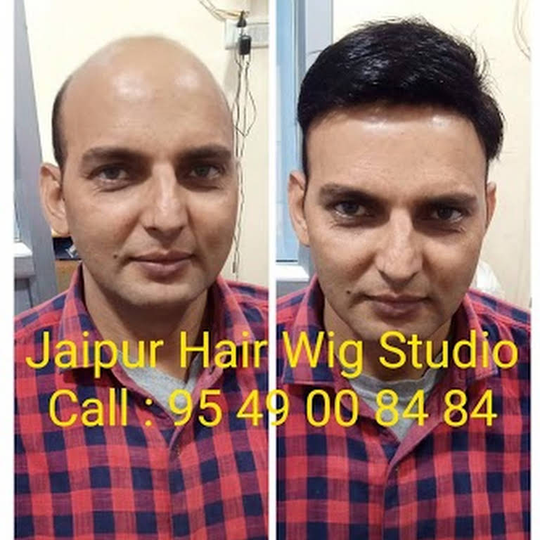 Jaipur Hair Wig Studio - Wig Shop in Jaipur, Hair Fixing, Tapping & Cilping  available. After use hair system you can comb, oil, shampoo, swim, drive &  any style.