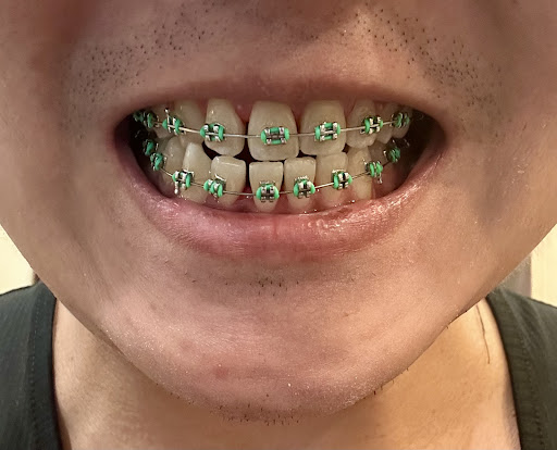 A Line Dental Braces Clinic Pte Ltd - Thumbnail