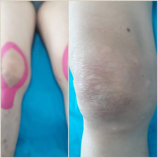 Rehabilítate Centro de Terapia Física y Rehabilitación - Thumbnail