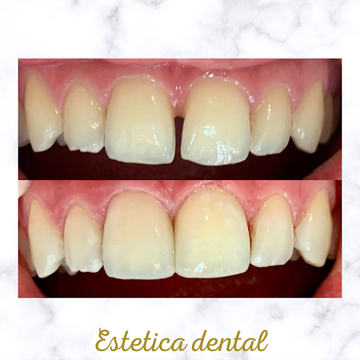Dental & estetic Gavà - Thumbnail