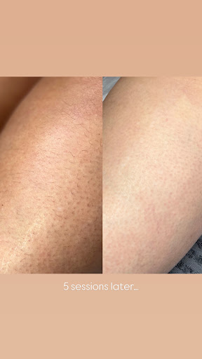 No Filter Clinic reading