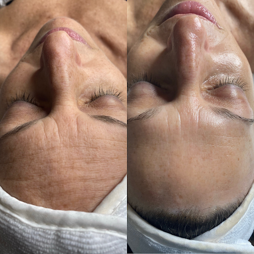 Ageless Glow Aesthetics - Thumbnail