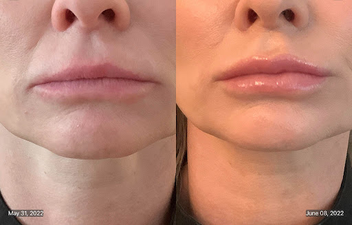 Ballentyne Medical Aesthetics