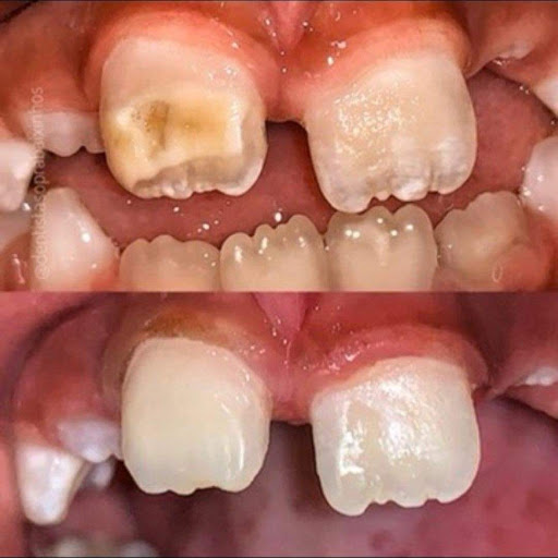 IMDENTAL - Visual