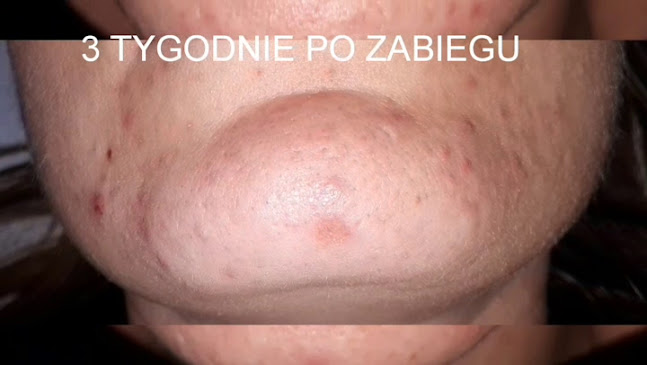 Opinie o Medycyna estetyczna Laseroterapia Chirurgia Ogólna- Dr n. med Monika Żuchowicz-Gil w Oświęcim - Lekarz