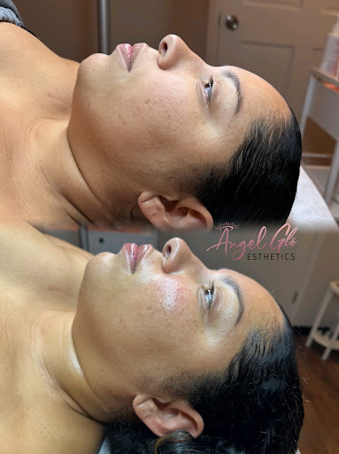 Angel Glō Skincare - Thumbnail