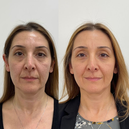 Best Cosmetologist In Mansarovar

#LUMINASKIN&AESTHETICCLINI