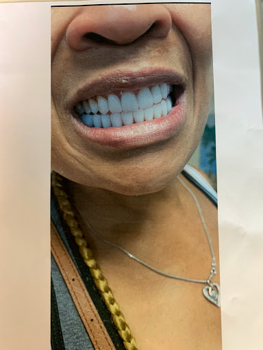 AApoLLo Dental Centers