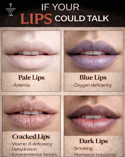 ✨ If Your Lips Could Talk – What Are They Telling You? ✨ post image