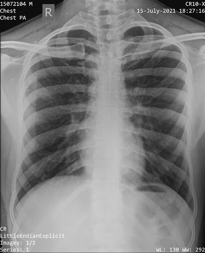 45+ Home X Ray Services In Pune