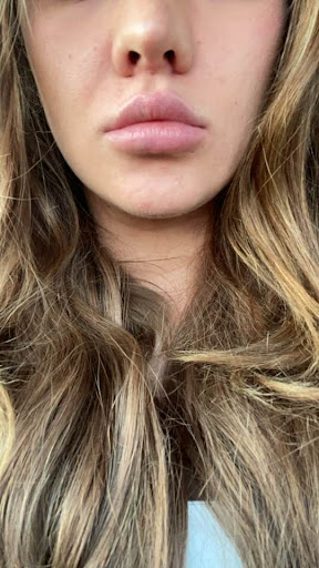 Ageless MedSpa Lakewood